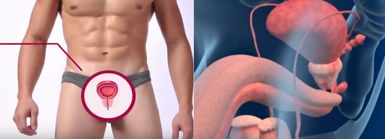 Prostatitis in men, distinguished by several signs